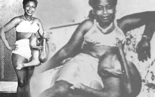 மிகவும் பிரபலமான மரபுபிறழ்ந்தவர்கள் - பெட்டி லூ வில்லியம்ஸ்